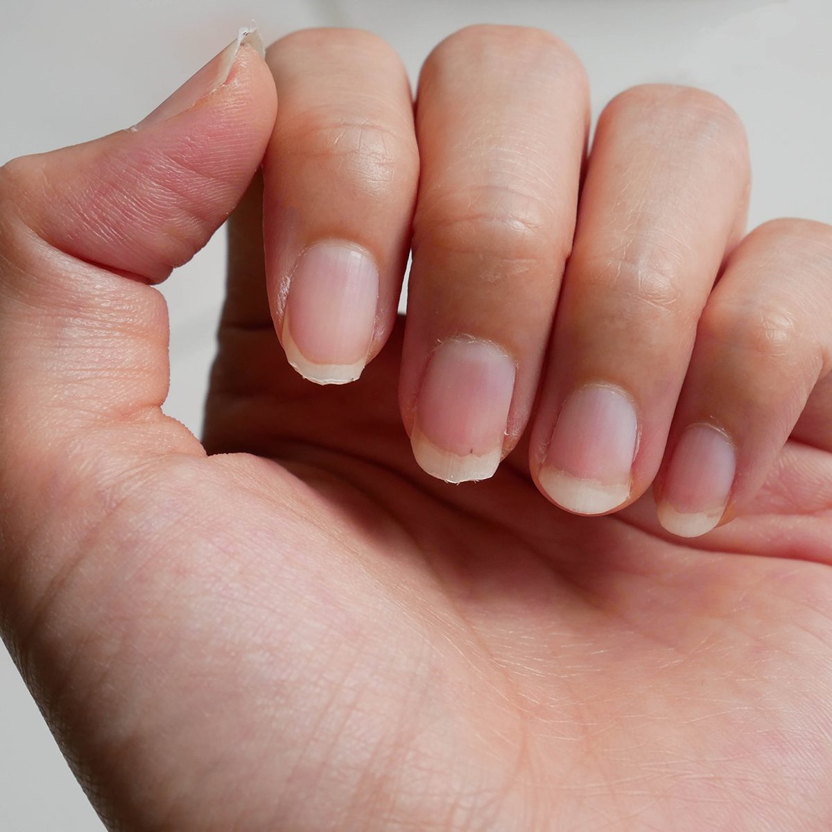 指甲缺乏营养,不使指甲形状和不关心,这张图片可以用于卫生保健的概念